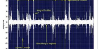 Düşük Devirde Rulmanların Analizi